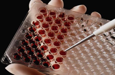 이성애를 통한 HIV 전파: 새로운 발견