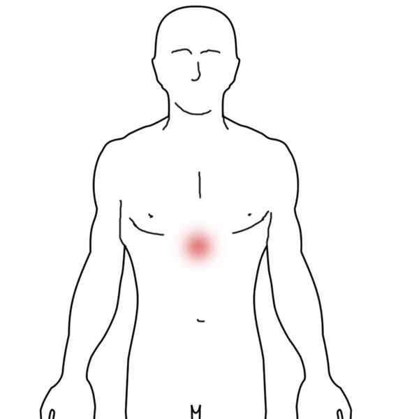 복부 신경총 통증