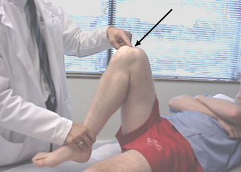 무릎을 굽힐 때 통증이 생기는 것이 사람들이 외상과를 찾는 가장 흔한 이유입니다.