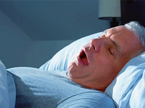 수면 무호흡증