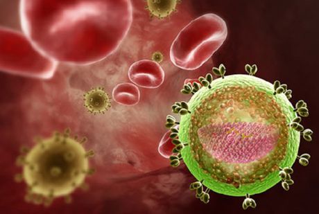 HIV = 에이즈