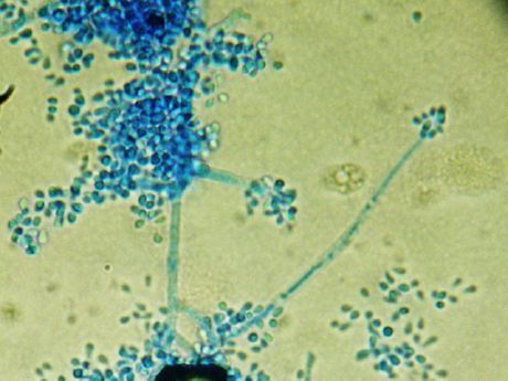 favus (Trichophyton schoenleinii)의 원인균